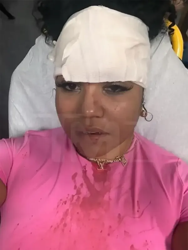 power 106 host bryhana injured by 50 cent microphone throw